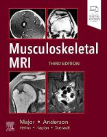 Musculoskeletal MRI E-Book (PDF eBook)