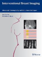 Interventional Breast Imaging: Ultrasound, Mammography, and MR Guidance Techniques (PDF eBook)