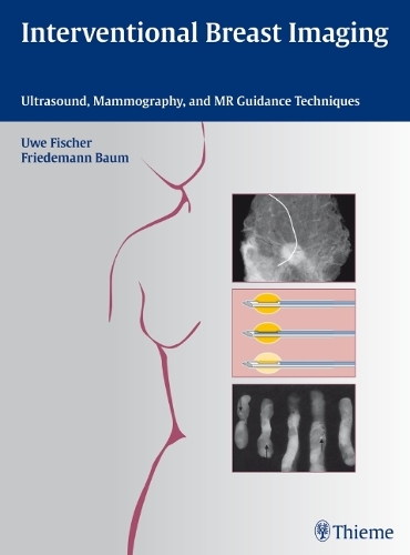Interventional Breast Imaging: Ultrasound, Mammography, and MR Guidance Techniques