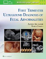 First Trimester Ultrasound Diagnosis of Fetal Abnormalities (ePub eBook)