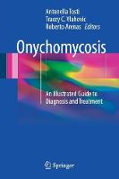 Onychomycosis: An Illustrated Guide to Diagnosis and Treatment (ePub eBook)