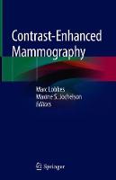 Contrast-Enhanced Mammography (ePub eBook)