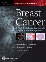 Breast Cancer: A Multidisciplinary Approach to Diagnosis and Management (ePub eBook)