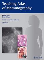 Teaching Atlas of Mammography (PDF eBook)