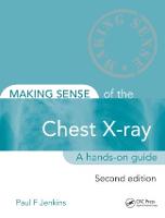 Making Sense of the Chest X-ray: A hands-on guide (PDF eBook)