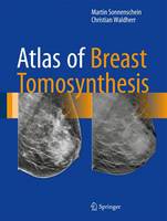 Atlas of Breast Tomosynthesis (ePub eBook)