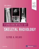 Fundamentals of Skeletal Radiology E-Book (ePub eBook)