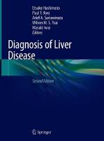 Diagnosis of Liver Disease (ePub eBook)