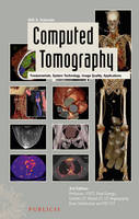Computed Tomography (PDF eBook)
