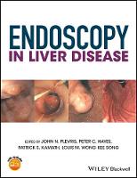 Endoscopy in Liver Disease (ePub eBook)