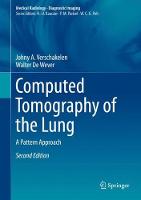 Computed Tomography of the Lung: A Pattern Approach (PDF eBook)