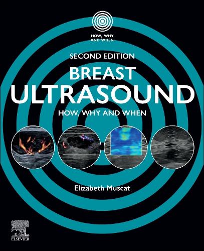 Breast Ultrasound: How, Why and When