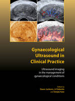 Gynaecological Ultrasound in Clinical Practice: Ultrasound Imaging in the Management of Gynaecological Conditions (PDF eBook)
