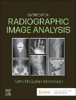 Radiographic Image Analysis - E-Book: Radiographic Image Analysis - E-Book (ePub eBook)