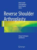 Reverse Shoulder Arthroplasty (ePub eBook)