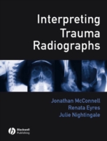 Interpreting Trauma Radiographs (PDF eBook)